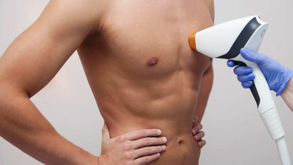 Métodos de depilação masculina e os riscos que ninguém te conta