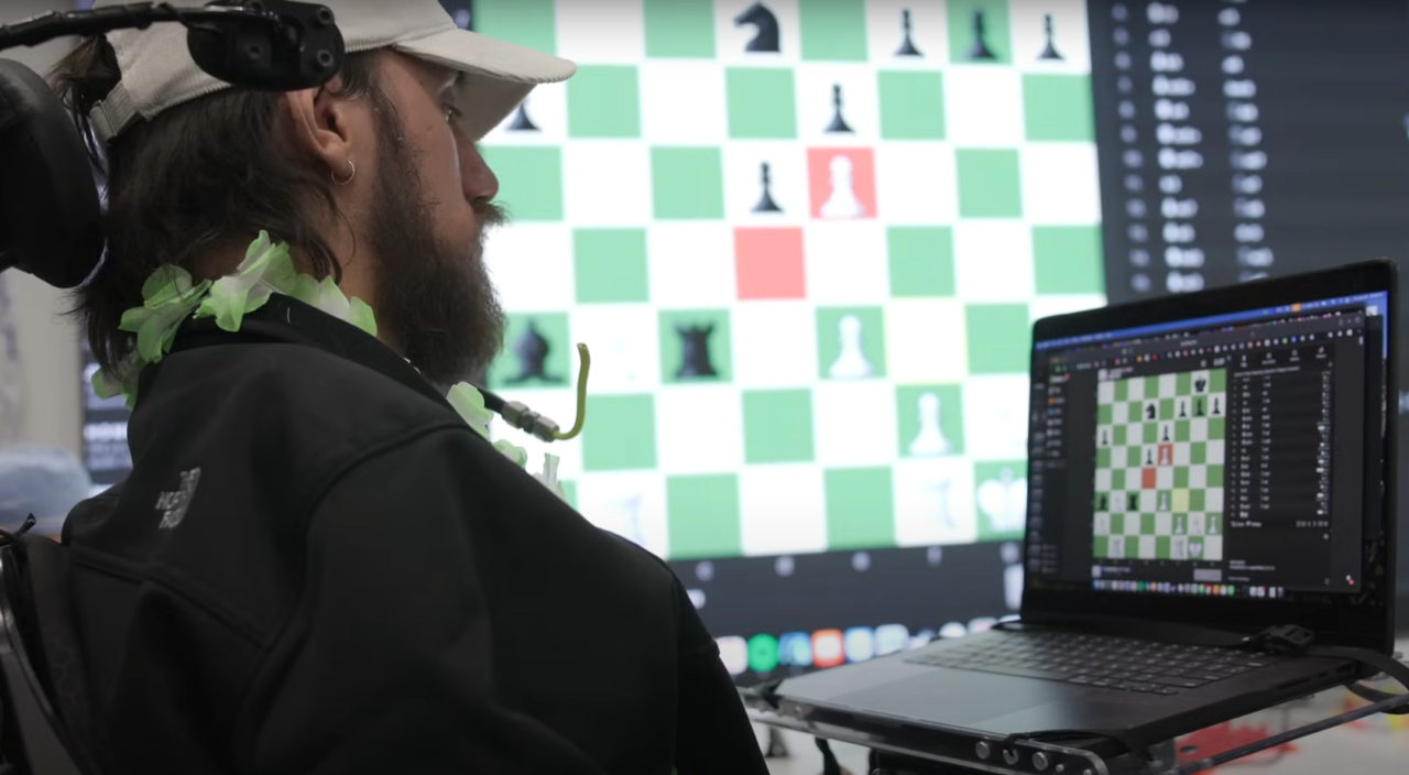 Dezoito meses depois de receber o chip cerebral, o primeiro paciente Neuralink de Elon Musk compartilha sua experiência