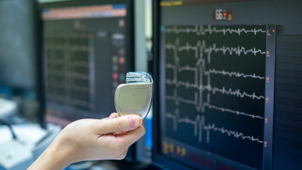 O que ninguém conta sobre viver com um marca-passo no coração