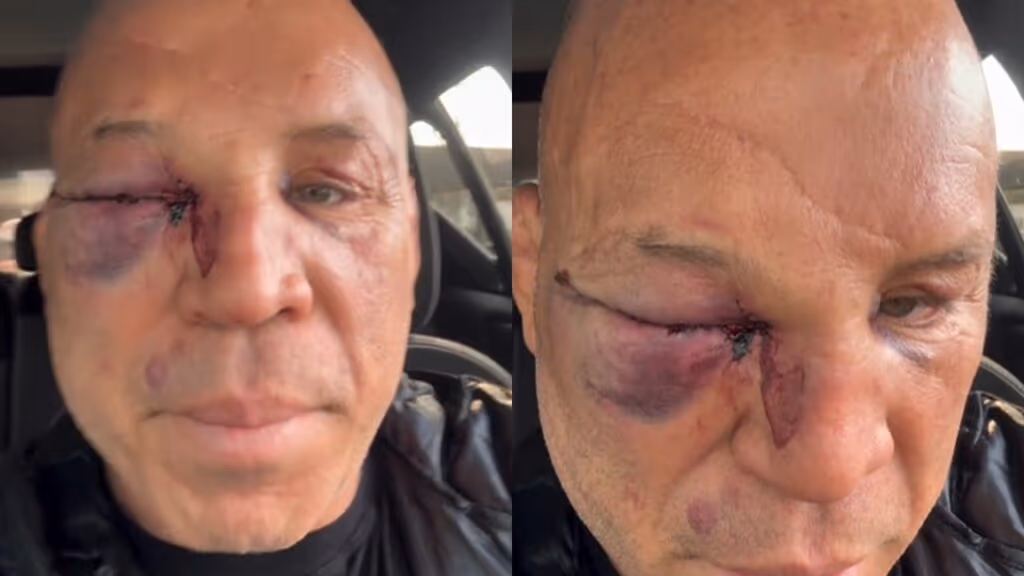 Wanderlei Silva enfrenta crise de saúde após caos no ringue com Popó