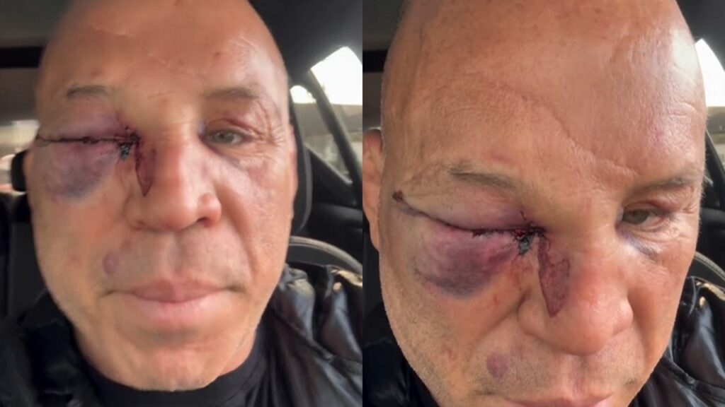 Wanderlei Silva enfrenta crise de saúde após caos no ringue com Popó