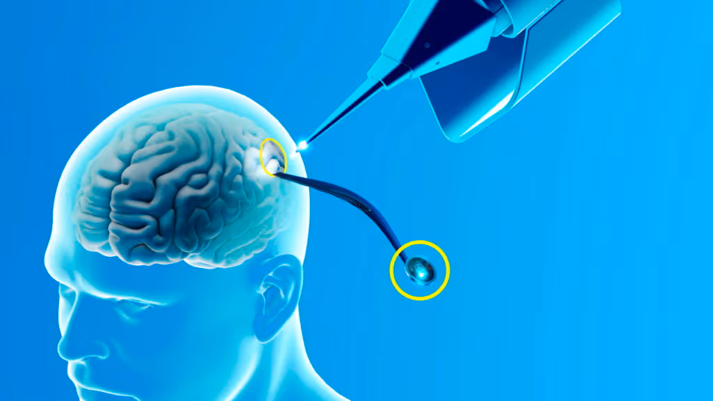 Pacientes tetraplégicos conseguiram controlar computador com o pensamento