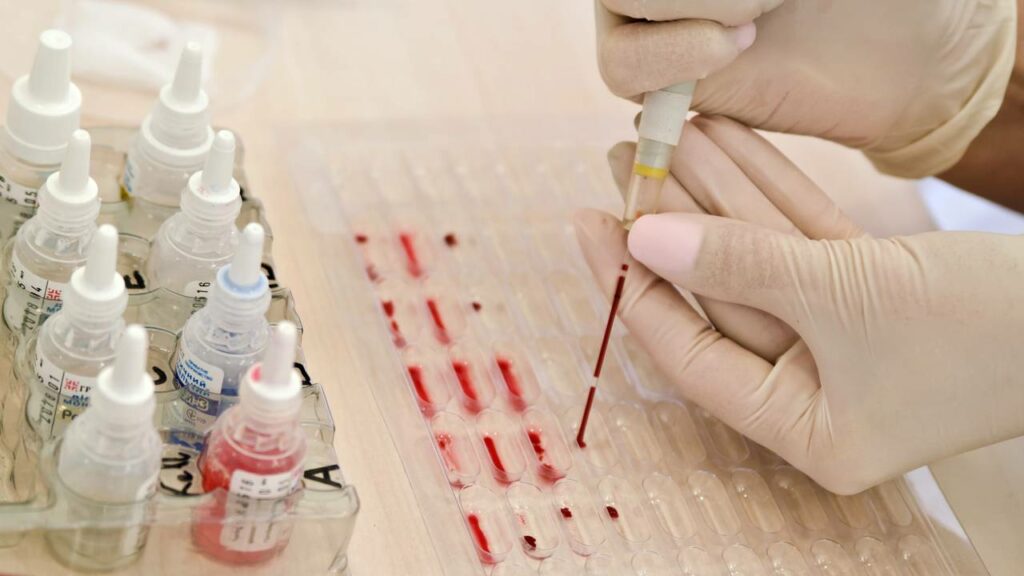 Quem tem esse tipo de sangue pode ter uma vida mais longa que os outros