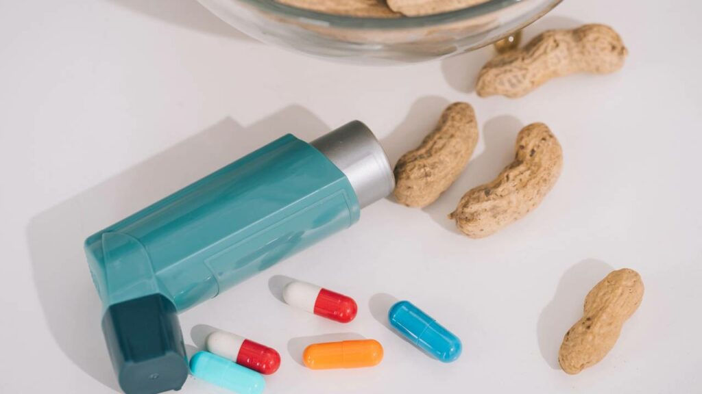 Como saber se você tem alergia a algum alimento de forma simples