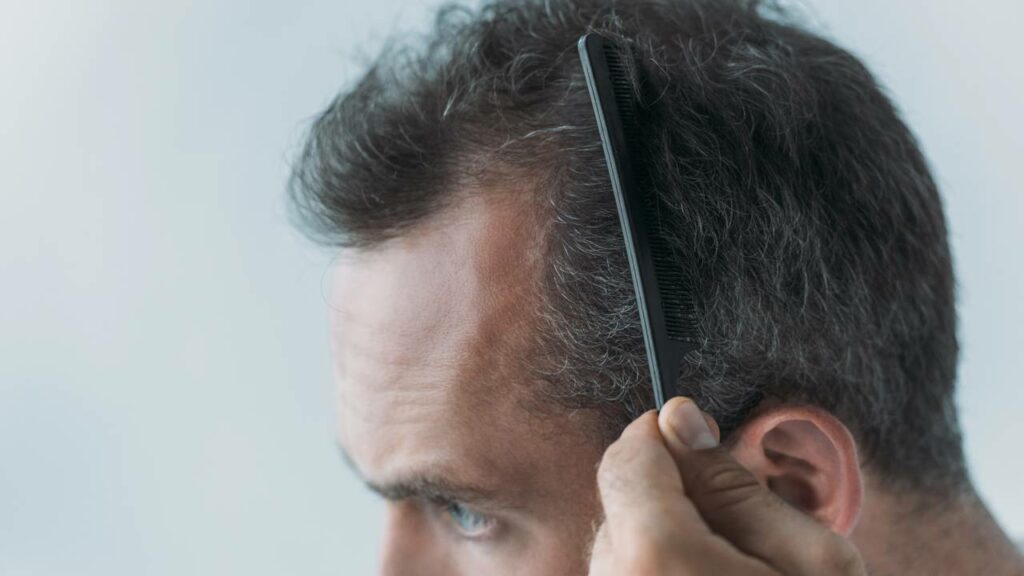 Cabelo caindo? Entenda as principais causas e como agir