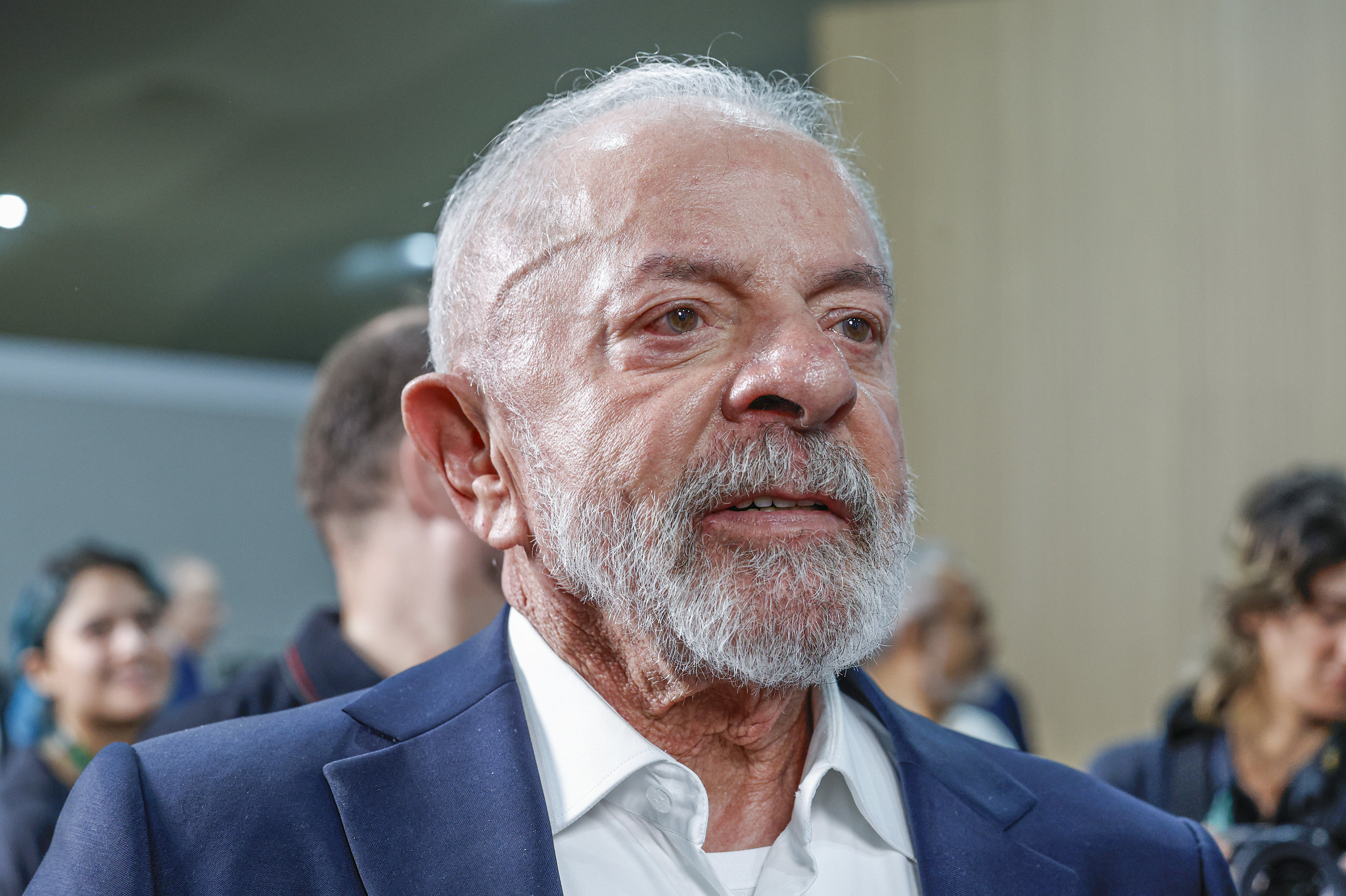 Lula passa por avaliação após cirurgia de catarata