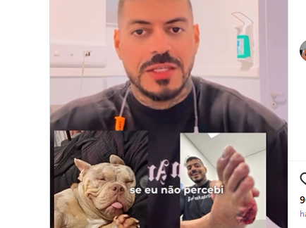 Influenciador tem o dedo comido pelo próprio cachorro enquanto dormia. E ele não sentiu?
