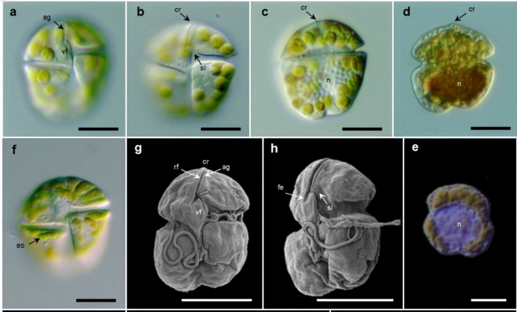 Observação microscópica das células da alga Karenia Cristata - Reprodução/University of Technology Sydney