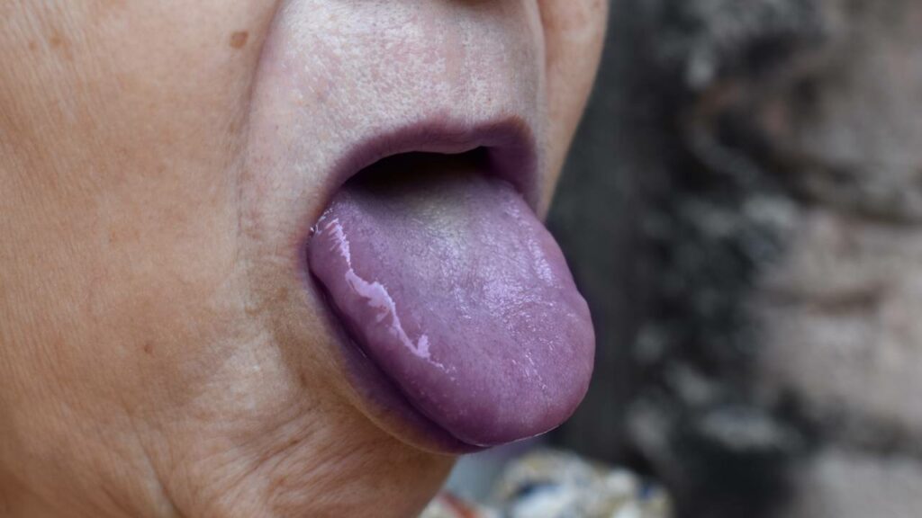 Jovem de 19 anos é preso após cortar a língua de idosa de 102 anos