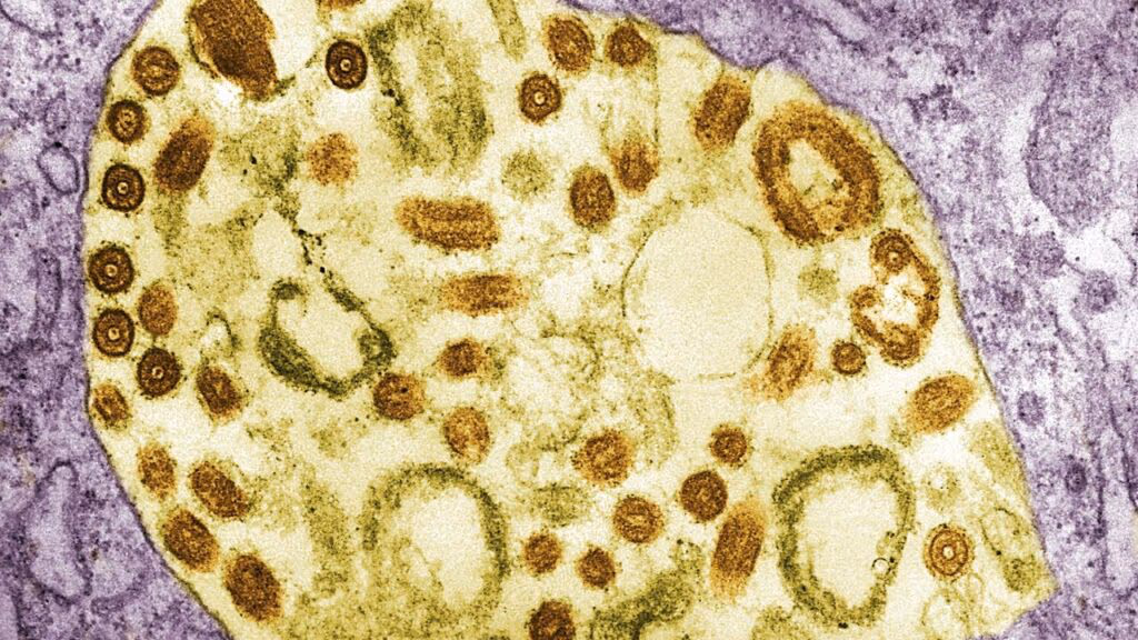 Vírus de Marburg reaparece na África e deixa mortos na Etiópia: OMS confirma surto preocupante