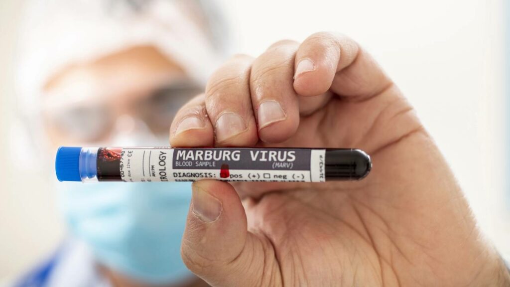 O vírus de Marburg é um parente próximo do vírus Ebola - Créditos: depositphotos.com / membio