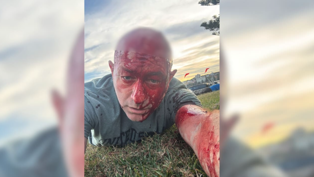 Advogado de direitos humanos relata horror em atentado na Austrália