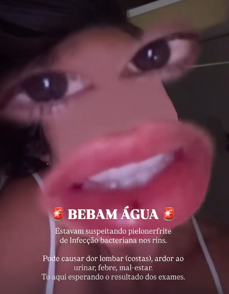 Ex-BBB é internada com infecção grave nos rins