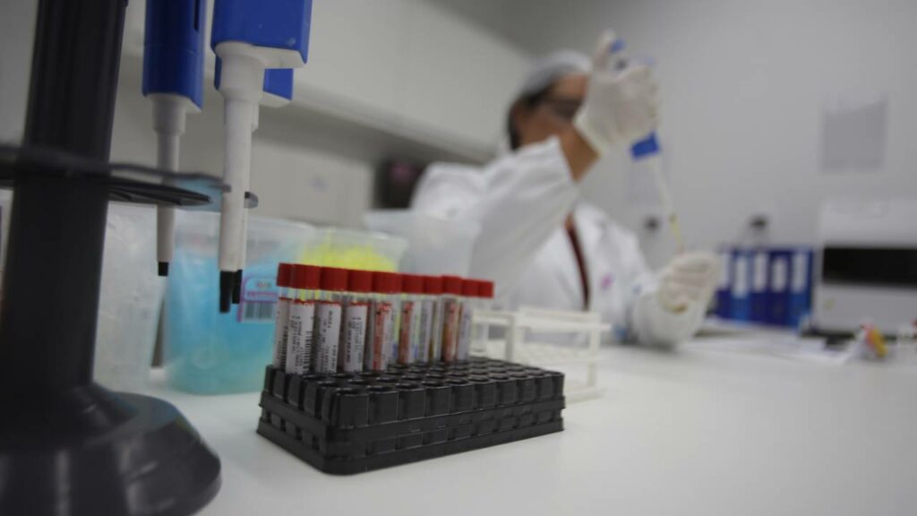 Como a recuperação de uma proteína perdida com a idade pode fortalecer a imunidade