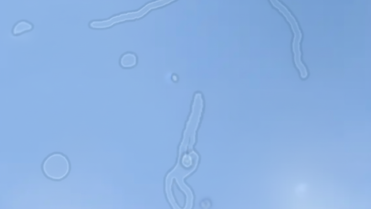 O que são moscas volantes na sua visão e por que elas aparecem?