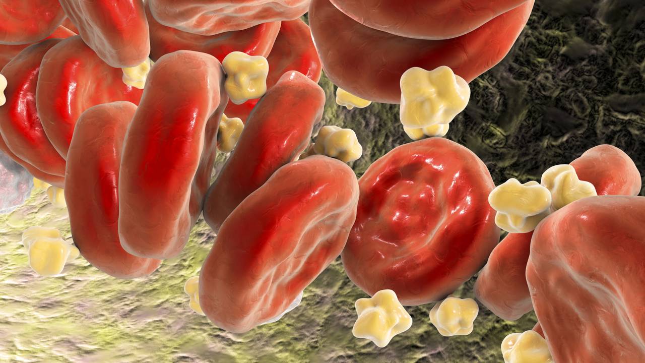 Essa falha invisível no colesterol pode estar sabotando seu coração