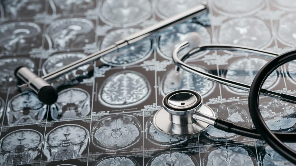 Ex‑jurada do MasterChef revela diagnóstico de infecção raríssima no crânio