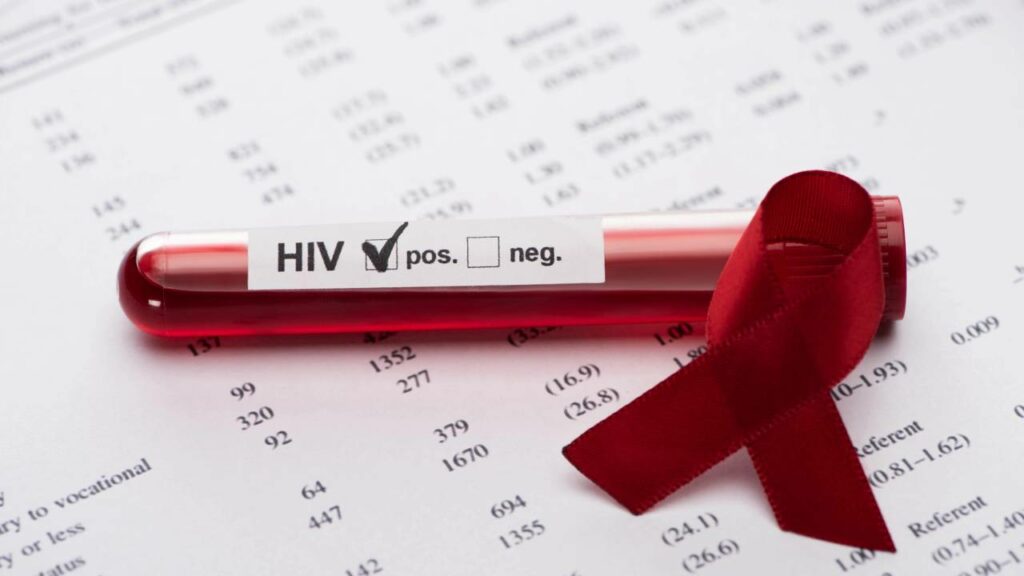 Sétimo paciente no mundo tem remissão do HIV
