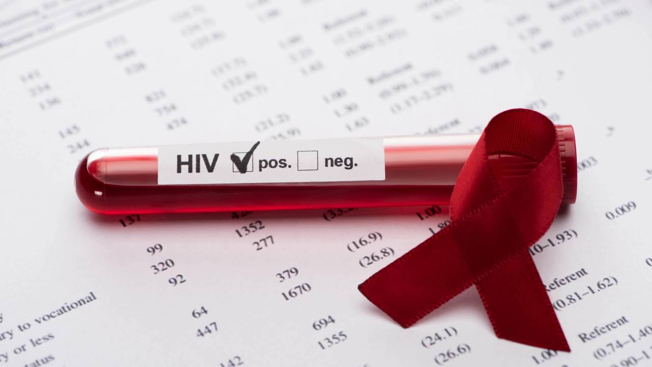 Sétimo paciente no mundo tem remissão do HIV