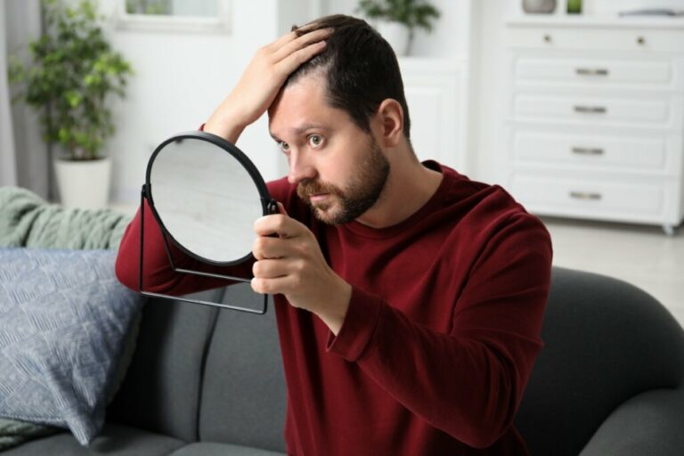 Calvície em homens e mulheres: entenda as diferenças e as causas