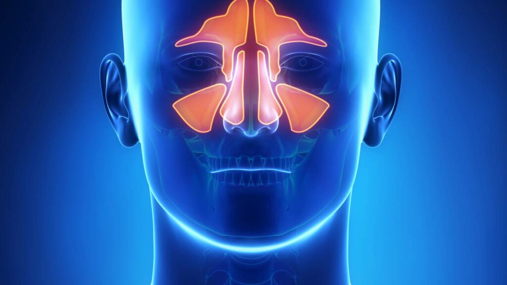 A sinusite consiste na inflamação dos seios da face, conhecidos como seios paranasais - Créditos: depositphotos.com / CLIPAREA
