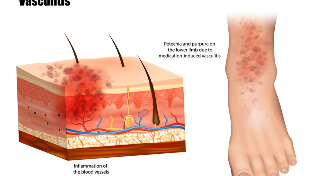 Lulu Santos revela diagnóstico que impactou sua carreira