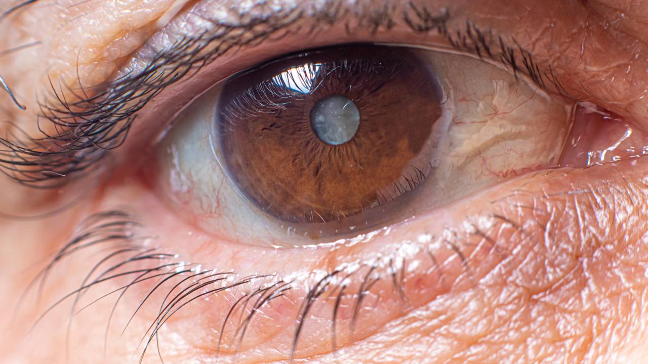 Essa é a causa por trás da visão embaçada que muita gente acha normal