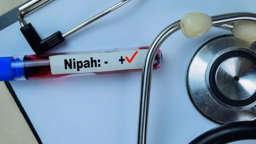 Vírus Nipah: o que é, como é transmitido e onde os casos estão acontecendo