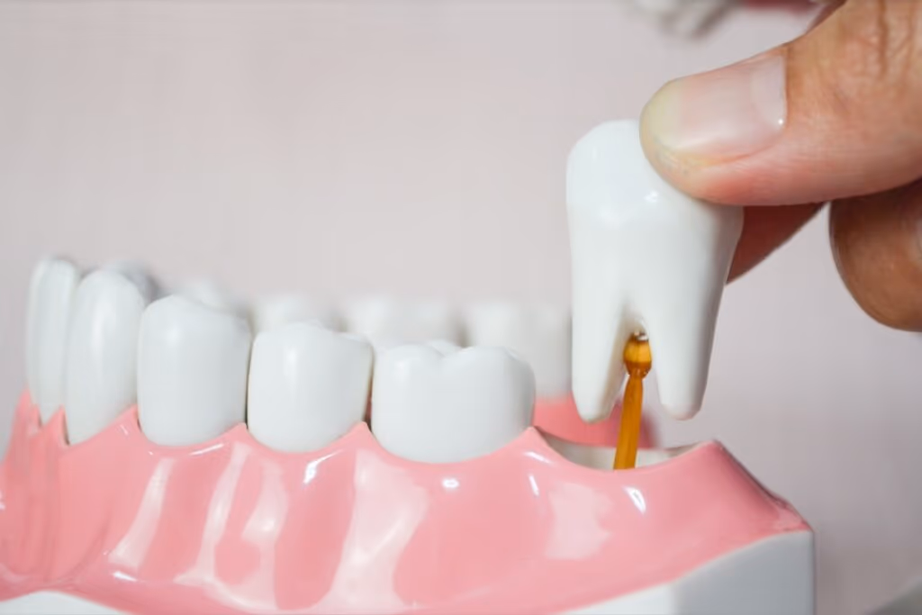 Dente do siso: por que algumas pessoas não têm?