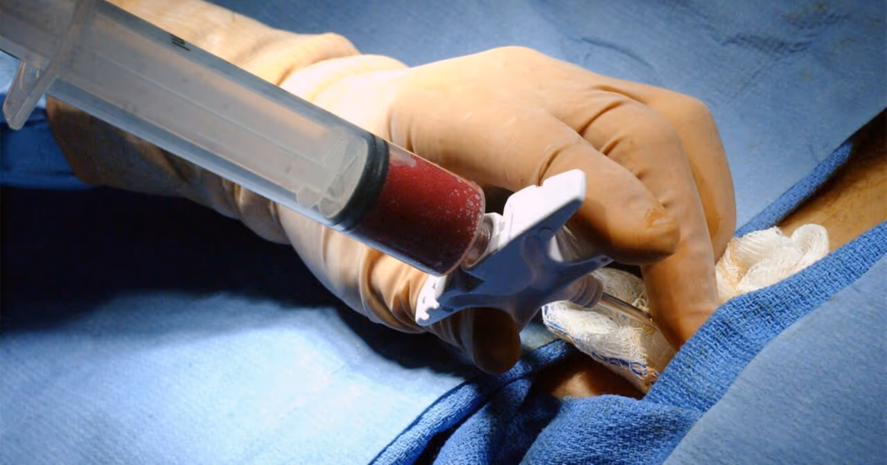 HC de SP chega a mil transplantes de medula em dez anos