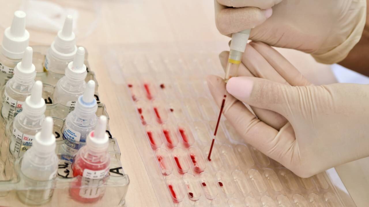 O que diz a ciência sobre um tipo de sangue especifico que retardar o envelhecimento