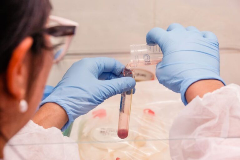 Combinação de IA e exame de sangue zera falhas no diagnóstico da hanseníase