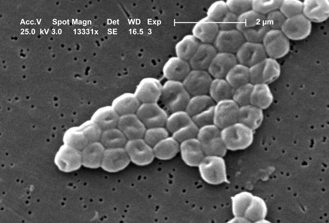 Superbactéria resistente a todos os antibióticos mata bebê prematuro em hospital de Porto Alegre; outros 7 podem estar infectados
