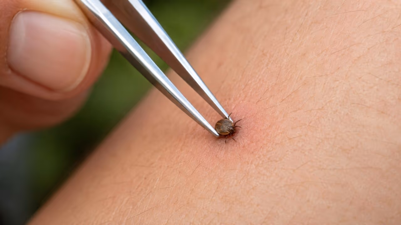 Como tirar carrapato do jeito certo sem machucar a pele nem aumentar o risco de infecção