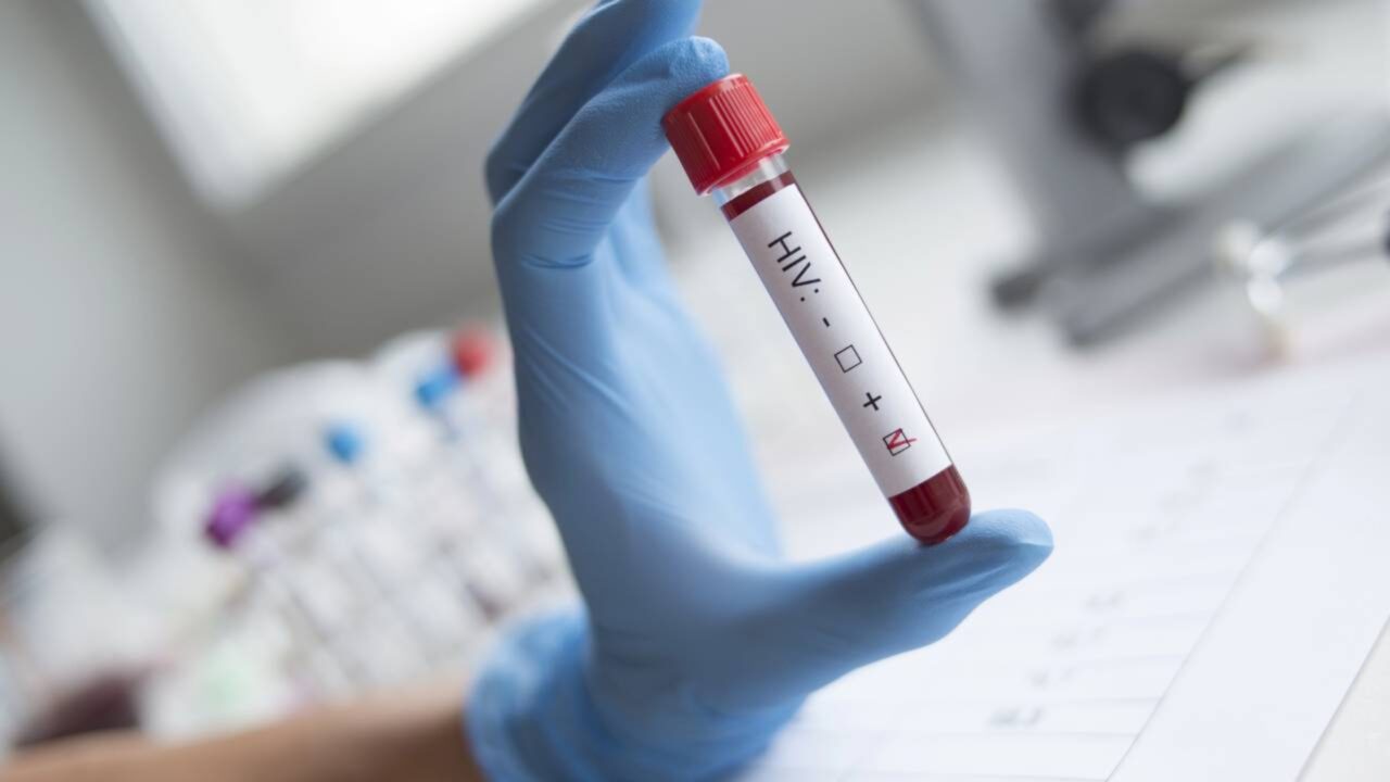 Universidade pública produzirá um medicamento contra o HIV infantil pela primeira vez