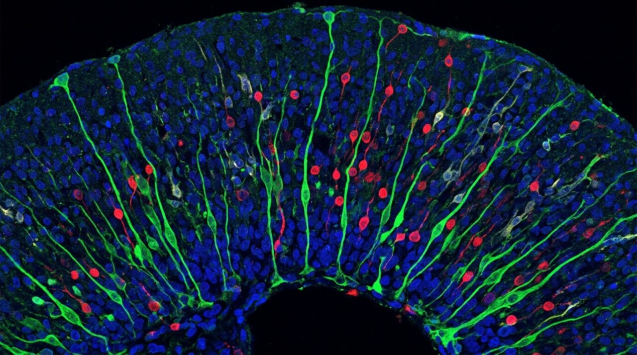 Menos glicose alterou a proporção de progenitores e neurônios produzidos no organoide