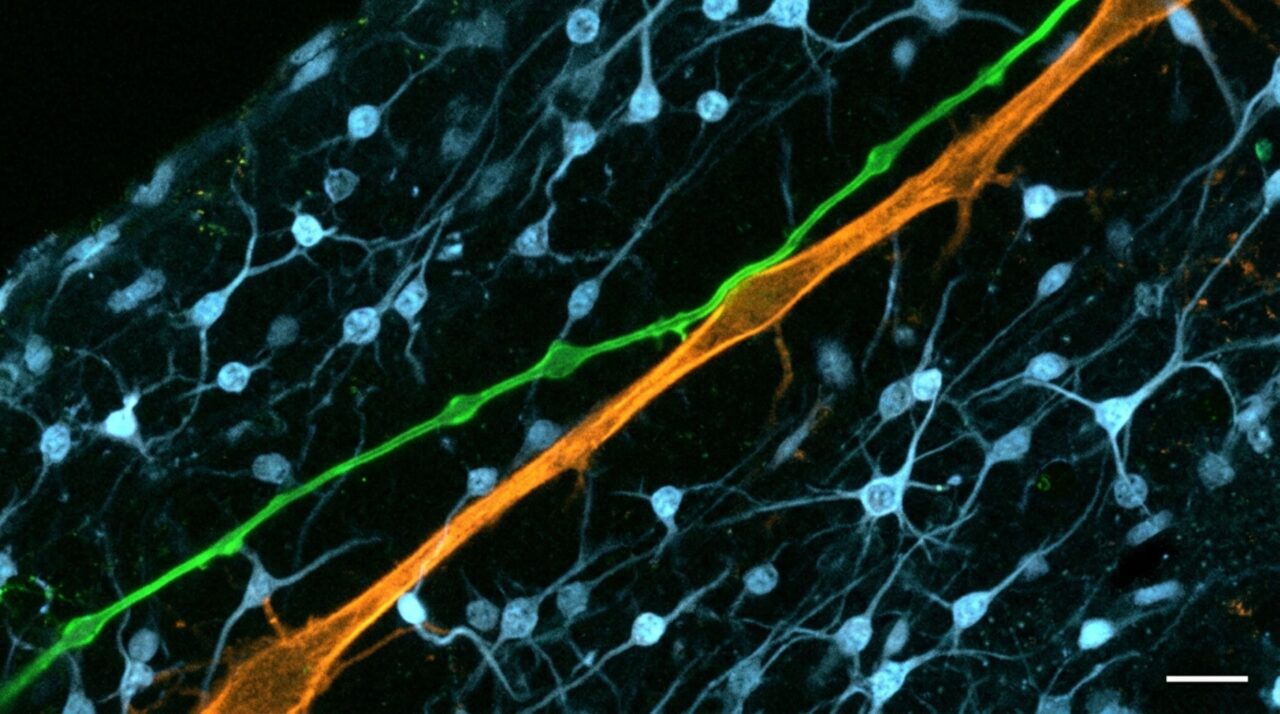 NRXN1 ajuda a sustentar o contato entre projeções talâmicas e glia radial externa