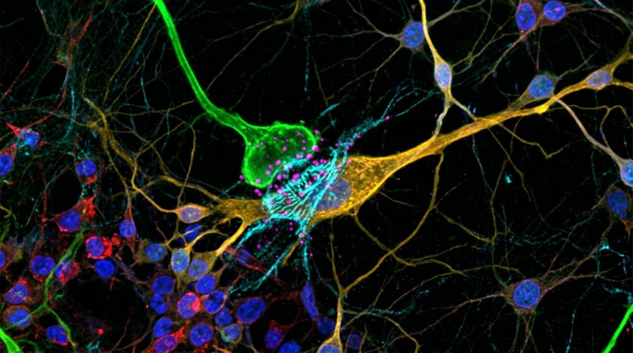 NRXN1 ajuda a regular o contato entre projeções talâmicas e progenitores corticais