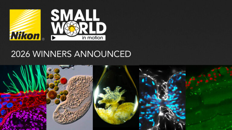 Nikon Small World in Motion: Imagens das vias aéreas de uma criança vencem prêmio de registros microscópicos