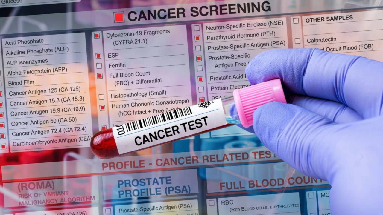 Câncer de próstata Tratamento inovador aumenta a sobrevivência de pacientes com metástases em dois anos, segundo estudo
