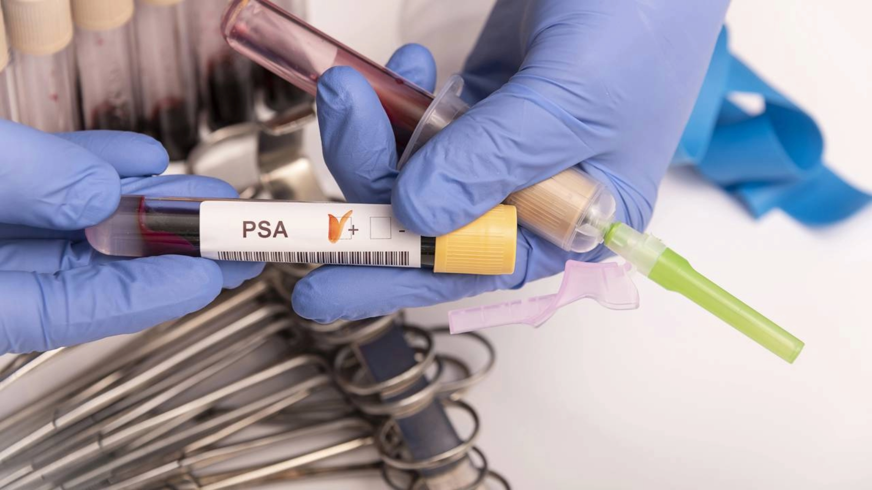 Câncer de próstata: Tratamento inovador aumenta a sobrevivência de pacientes com metástases em dois anos, segundo estudo